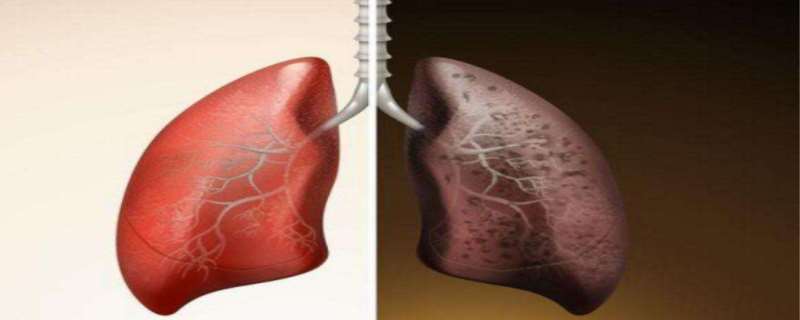 戒烟1年后肺有什么变化  戒烟1年后有什么变化