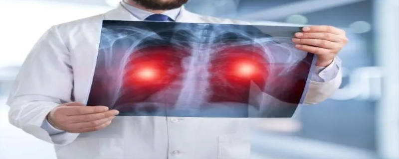 肺的作用 肺癌的早期症状和前兆