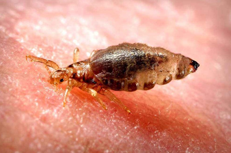  虱子的生长周期是多久 虱子离开人体能存活多长时间
