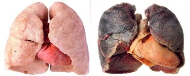 抽烟的肺需要多久才能恢复 抽烟的肺能洗吗