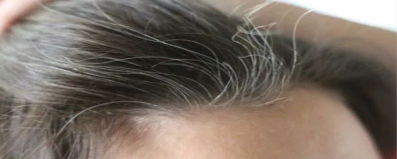 白头发怎么调理变黑发，白头发多是什么原因引起的