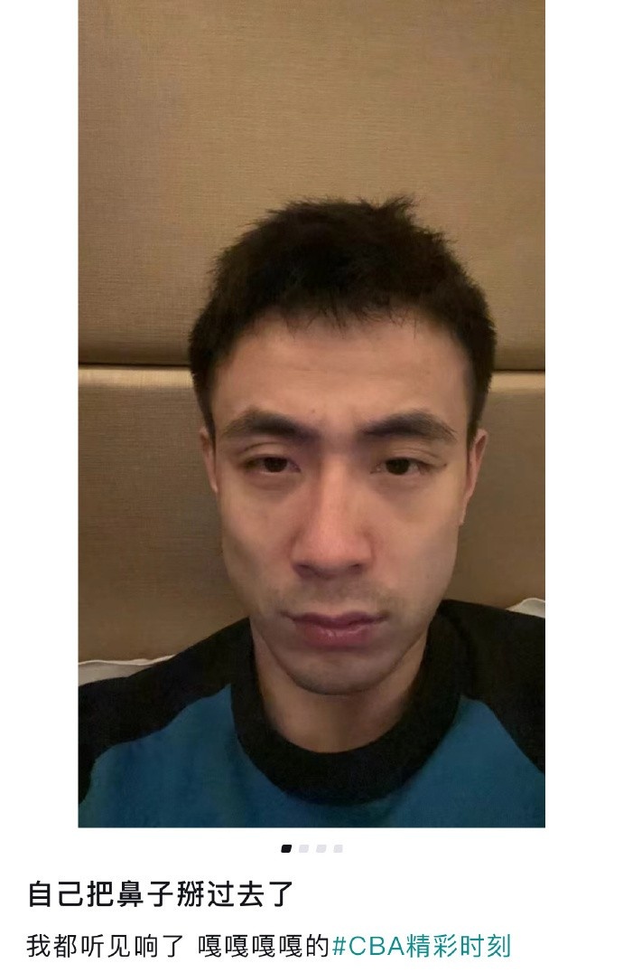 听着都疼赵继伟晒自拍：自己把鼻子掰过去了听见嘎嘎响