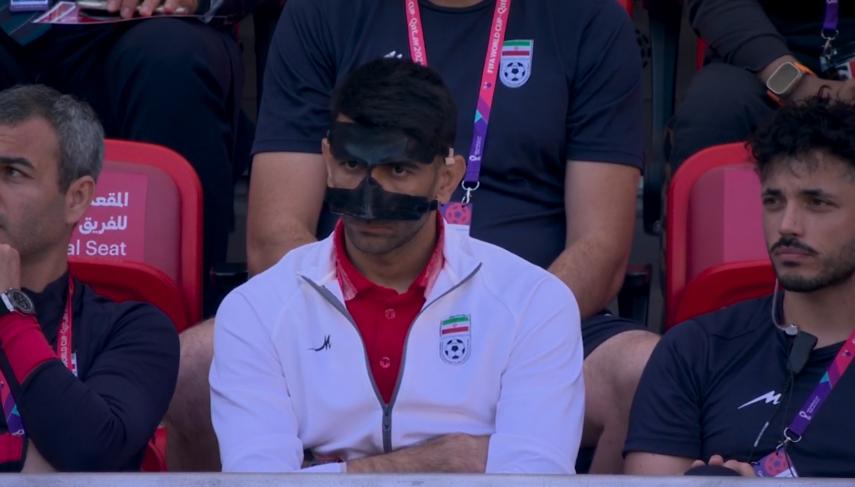 伊朗门将贝兰万德出现在替补席上，面部佩戴黑色面具